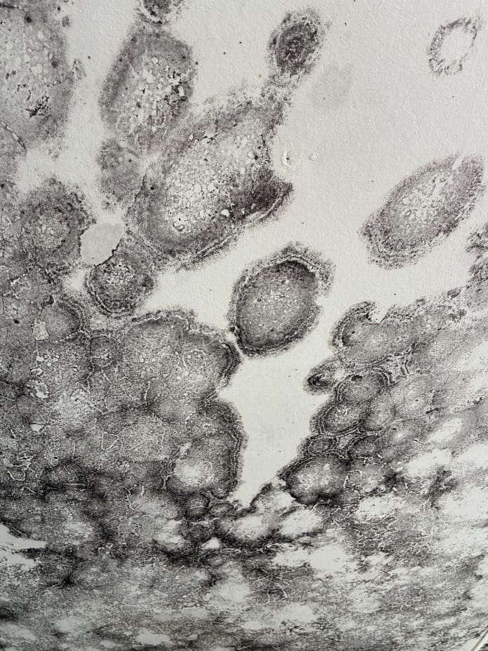 Black mould explained